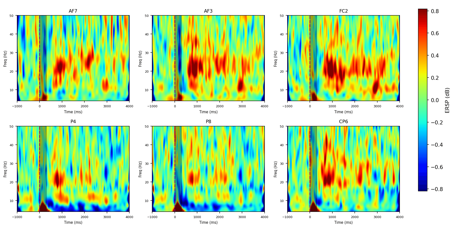 EEG spectrograms showing spectral power changes over time by channel, with warmer colors indicating upregulation after stimulation